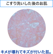 こすり洗いした後のお肌 キメが壊れてキズが付いた肌。